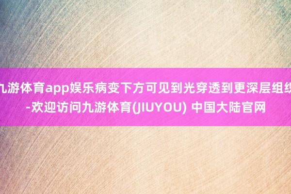 九游体育app娱乐病变下方可见到光穿透到更深层组织-欢迎访问九游体育(JIUYOU) 中国大陆官网